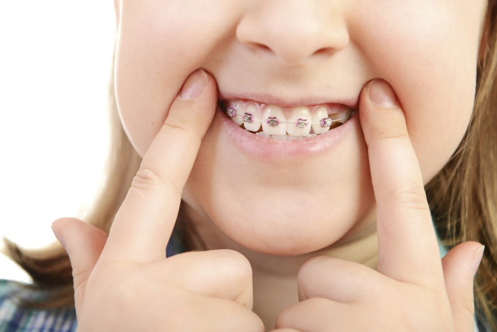 Laser Dent Kids Los Olivos